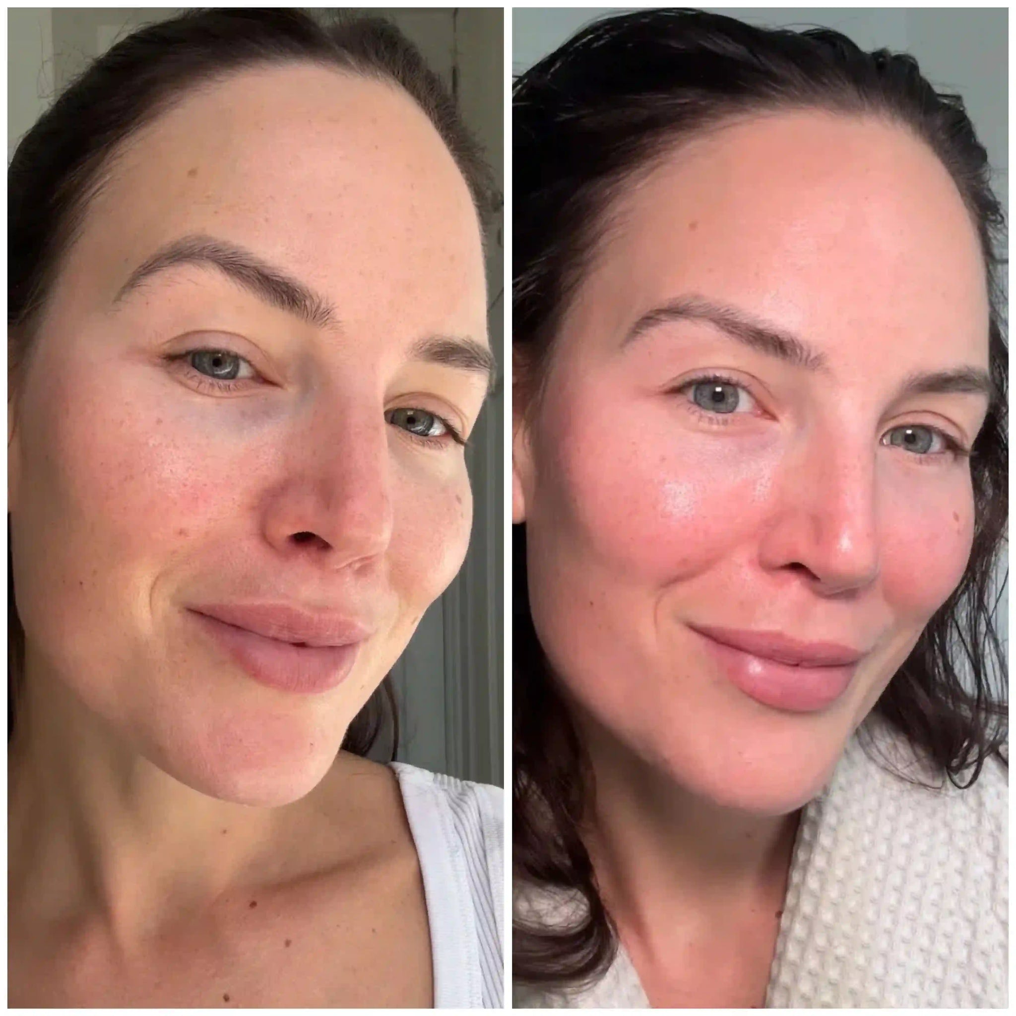 Before and after results of a woman after treatment