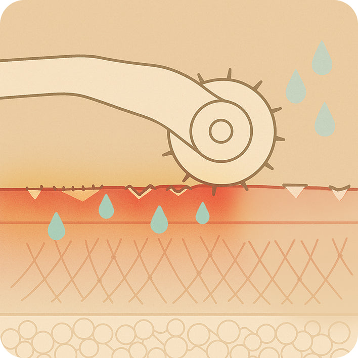 derma Roller Skin Injury Simulation